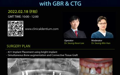 18.02.2022 Dentium Live Surgery