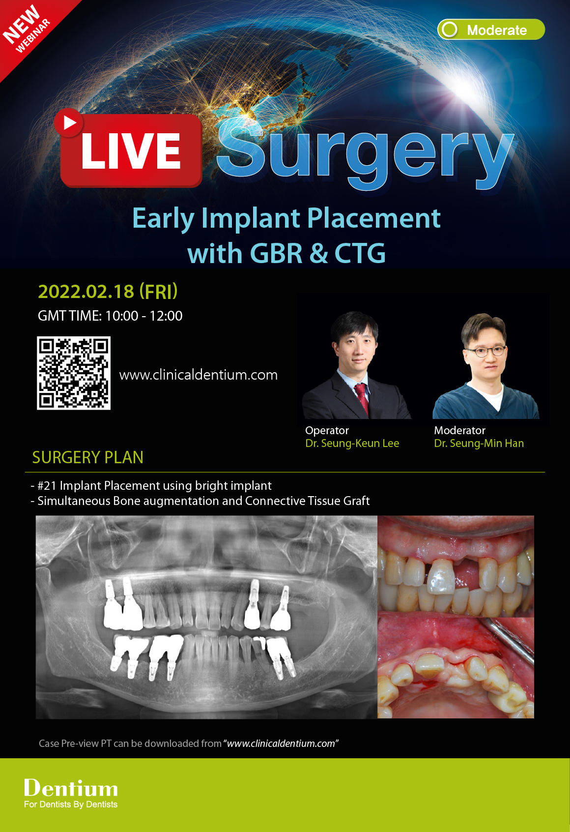 18.02.2022 Dentium Live Surgery