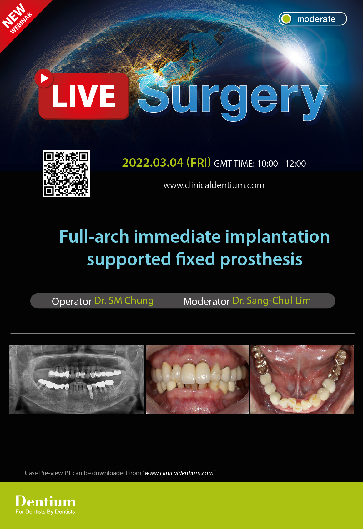 04.03.2022 Dentium Live Surgery