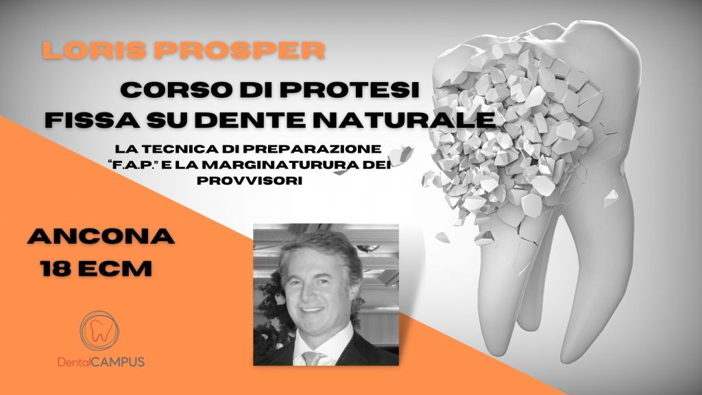 LORIS PROSPER – CORSO DI PROTESI FISSA SU DENTE NATURALE