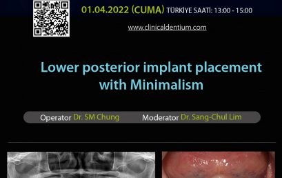 01.04.2022 Dentium Live Surgery