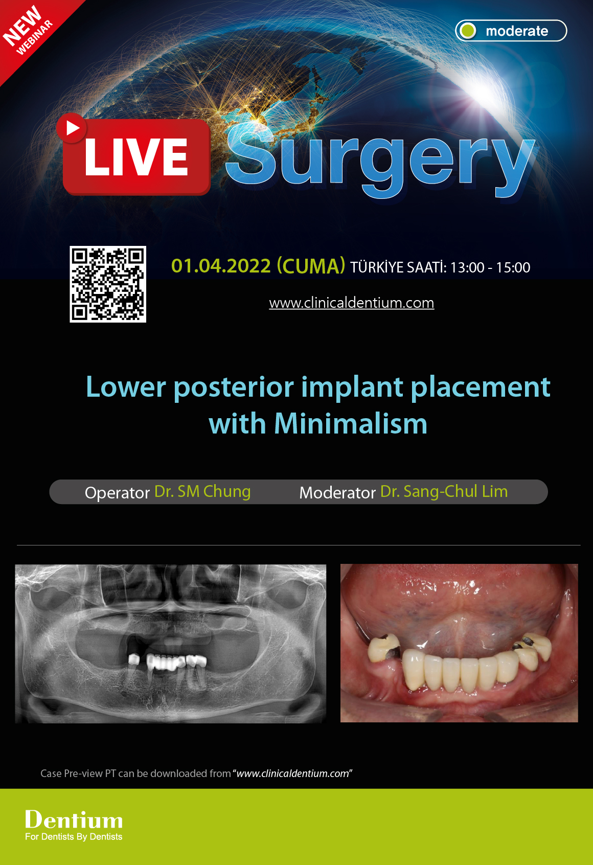 01.04.2022 Dentium Live Surgery