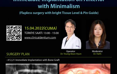 15.04.2022 Dentium Live Surgery
