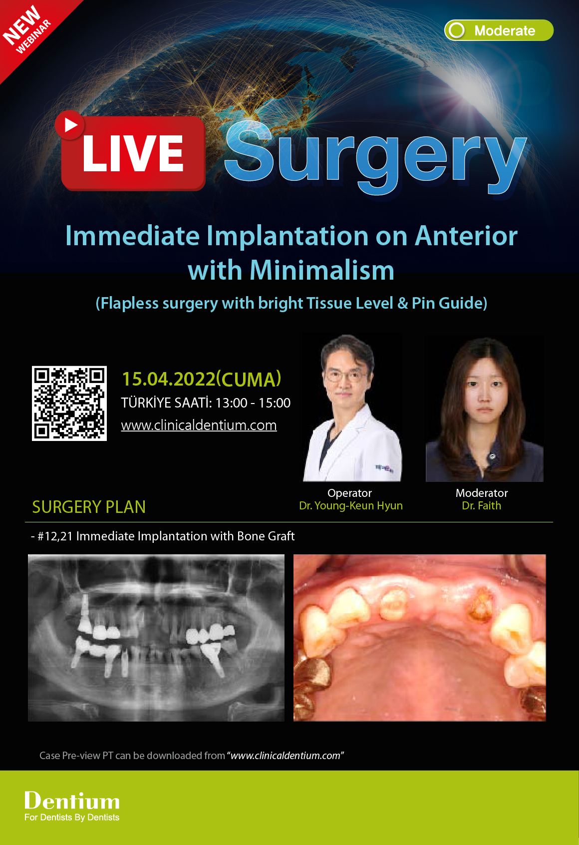 15.04.2022 Dentium Live Surgery