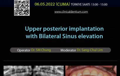 06.05.2022 Dentium Live Surgery