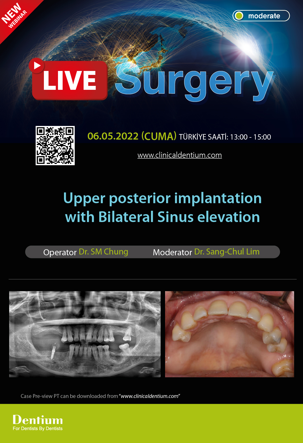 06.05.2022 Dentium Live Surgery