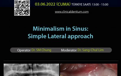 03.06.2022 Dentium Live Surgery