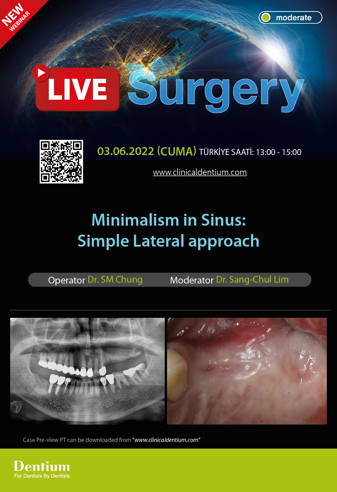 03.06.2022 Dentium Live Surgery
