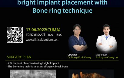 17.06.2022 Dentium Live Surgery