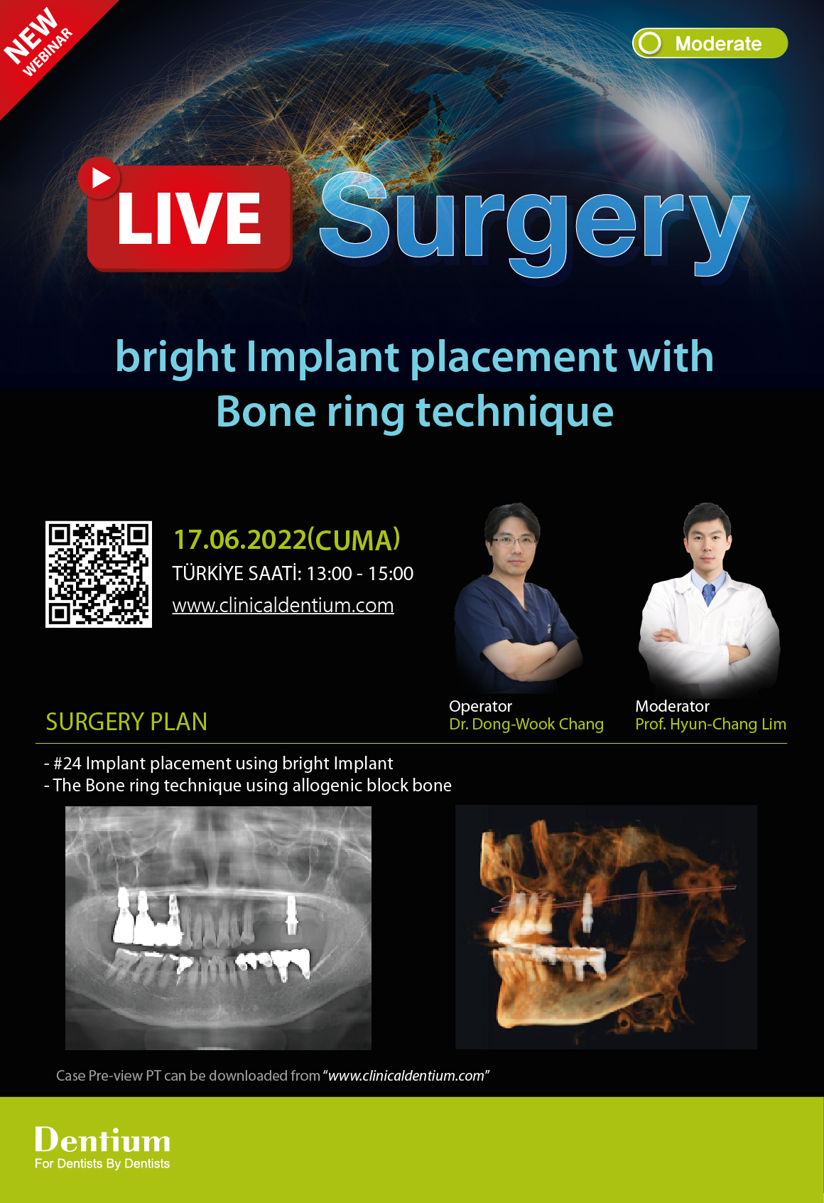 17.06.2022 Dentium Live Surgery