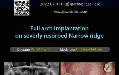 01.07.2022 Dentium Live Surgery