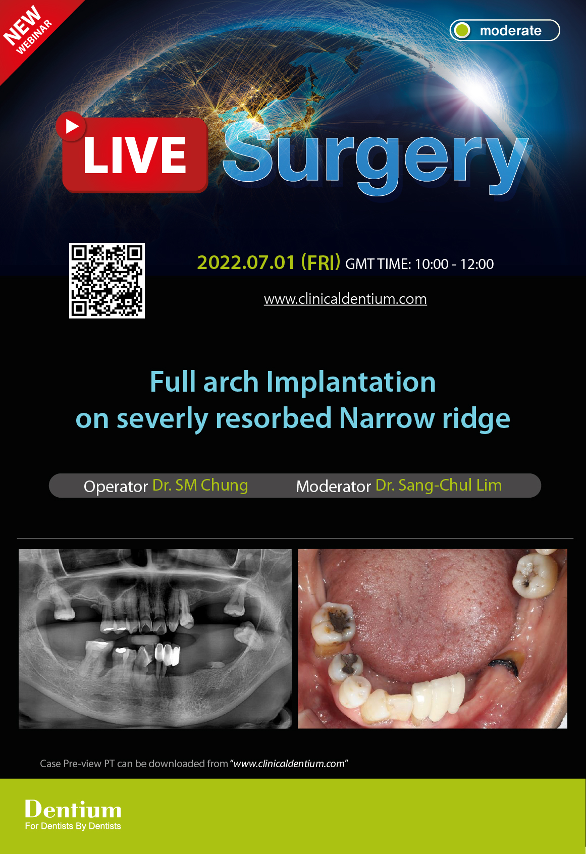 01.07.2022 Dentium Live Surgery