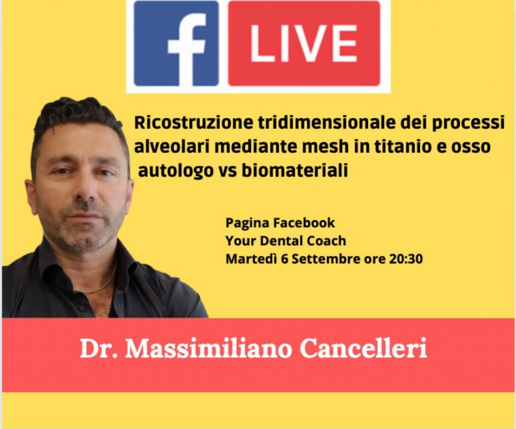 Ricostruzione tridimensionale dei processi alveolari