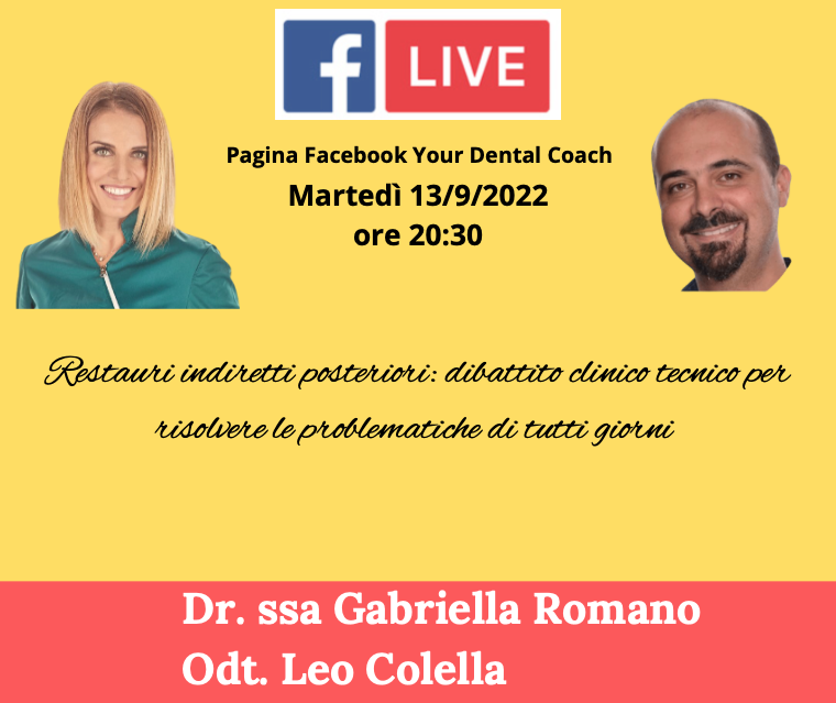 Restauri indiretti posteriori