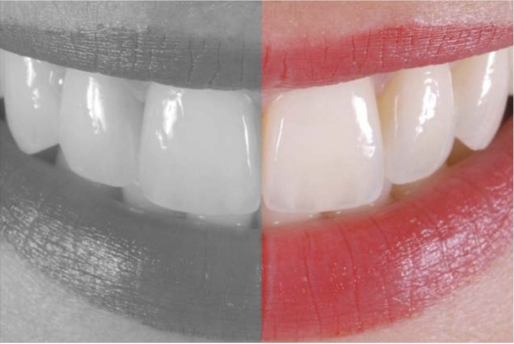 IL CORSO SBIANCAMENTO-CARIOLOGIA PIU’ FREQUENTATO IN ITALIA