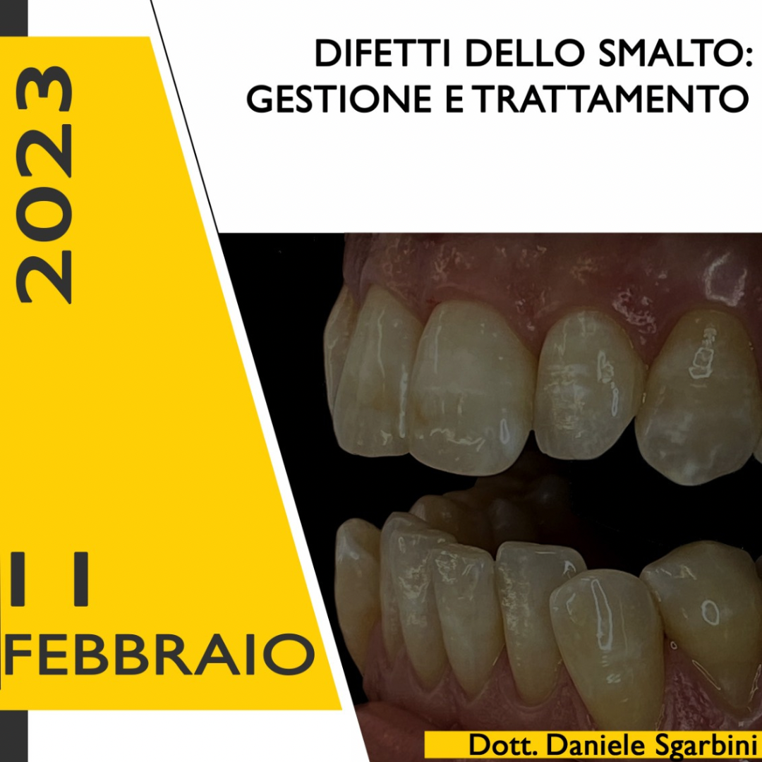 Difetti dello smalto: gestione e trattamento