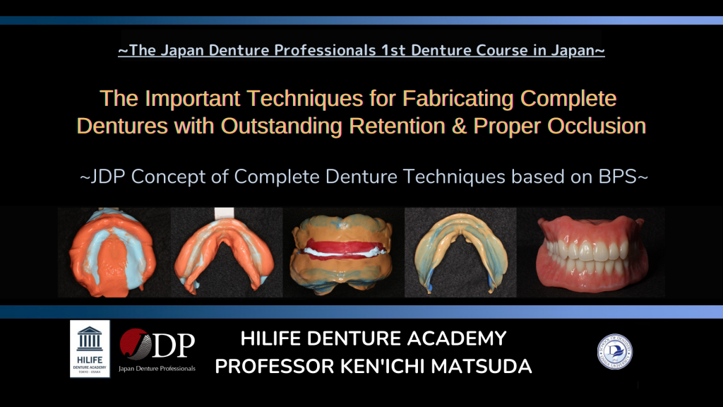 Complete Dentures Outstanding Retention & Proper Occlusion