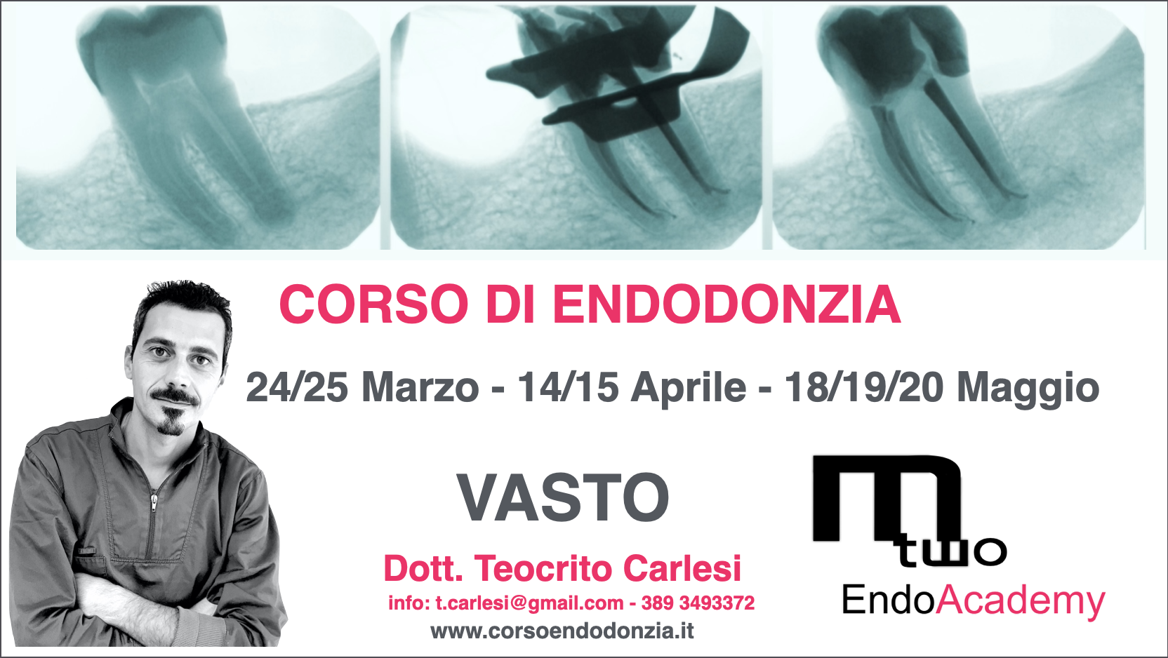Corso Endodonzia