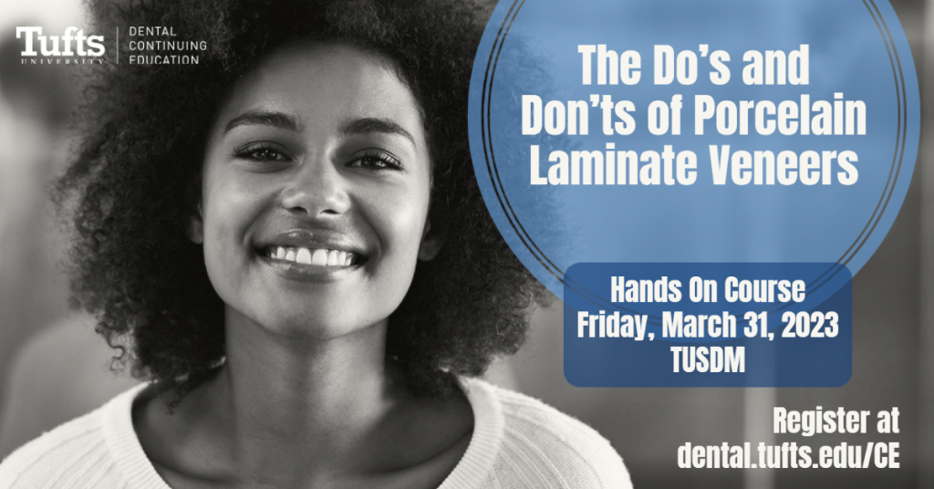 The Do’s and Don’ts of Porcelain Laminate Veneers