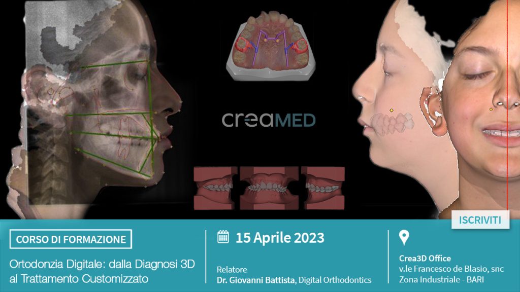 “Ortodonzia digitale: dalla diagnosi 3D al trattamento customizzato”