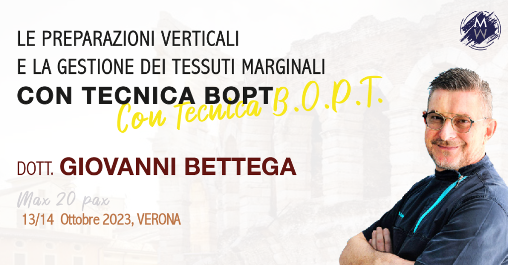 LE PREPARAZIONI VERTICALI E GESTIONE DEI TESSUTI MARGINALI CON TECNICA