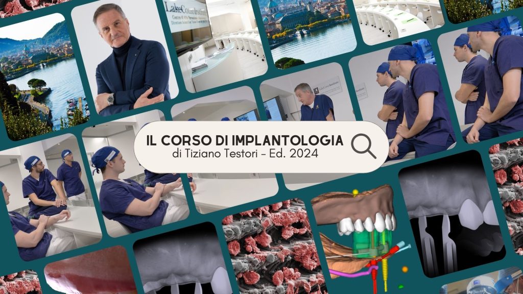 Il Corso di Implantologia di Tiziano Testori ed. 2024