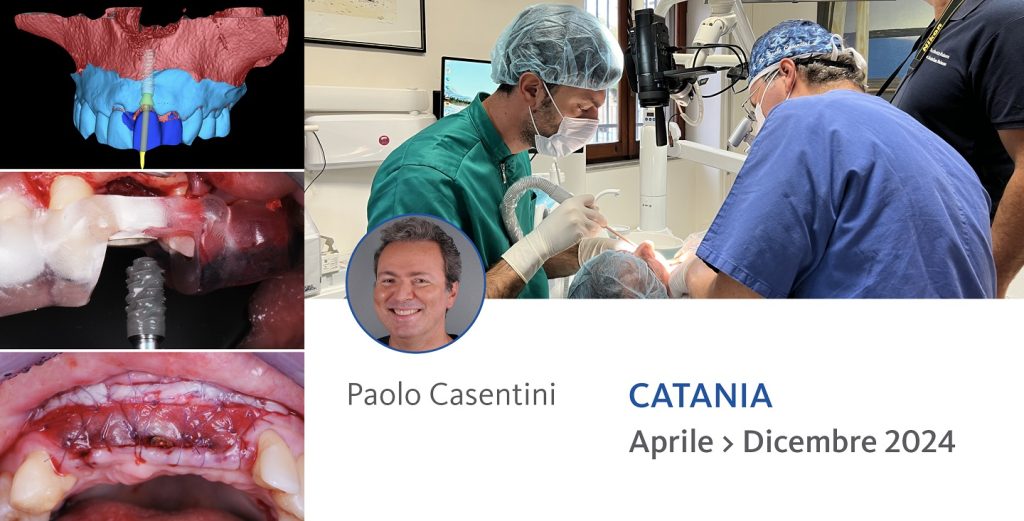 TUTORING IN IMPLANTOLOGIA DIGITALE, PGR E CHIRURGIA MUCOGENGIVALE