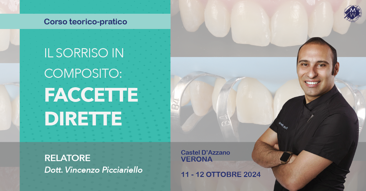IL SORRISO IN COMPOSITO: FACCETTE DIRETTE