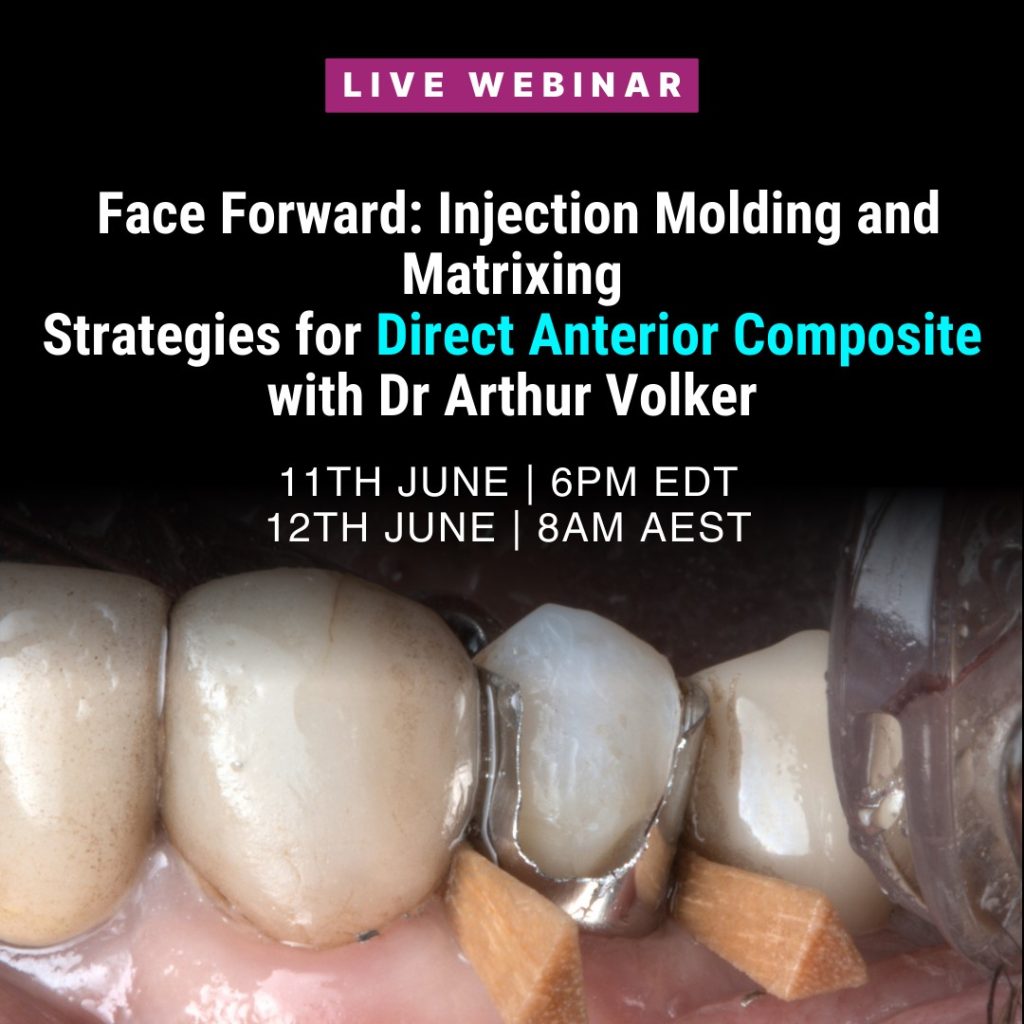 Face Forward : Injection Molding and Matrix Techniques