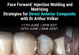 Face Forward : Injection Molding and Matrix Techniques