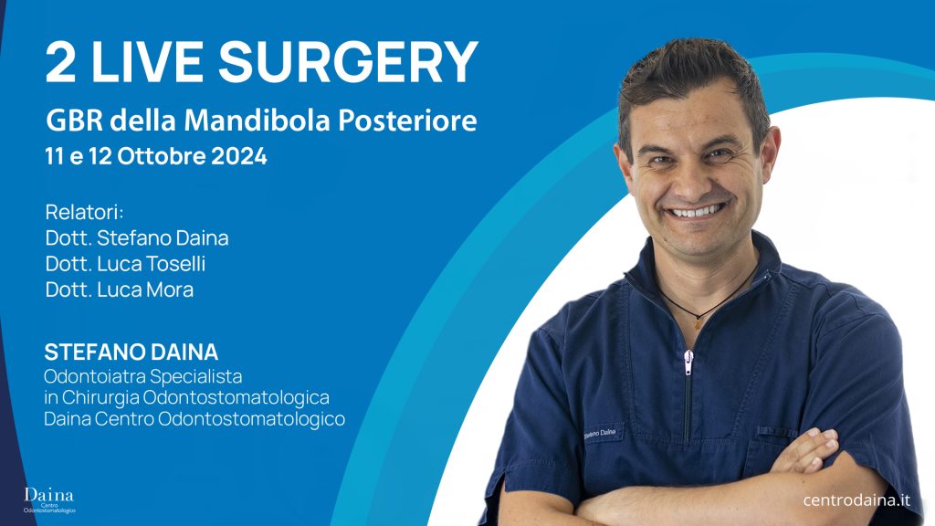 2 Live Surgery – GBR della Mandibola Posteriore