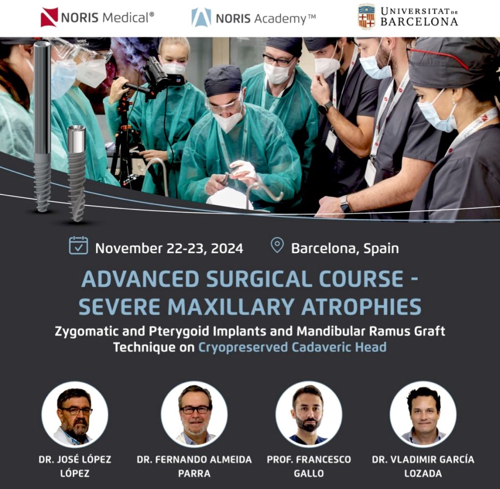 ADVANCED SURGICAL COURSE –  Zygomatic and Pterygoid Implants
