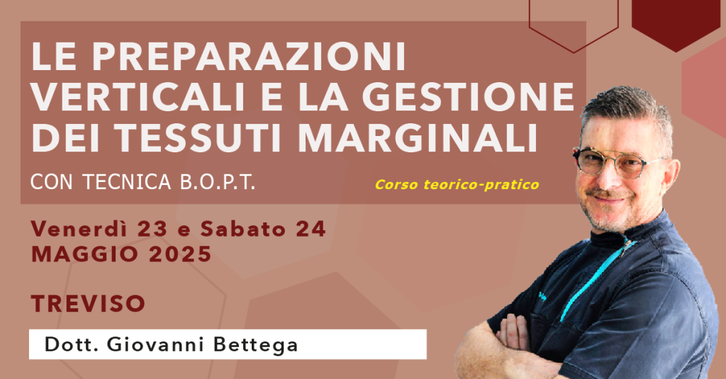 Le preparazioni verticali e la gestione dei tessuti marginali B.O.P.T