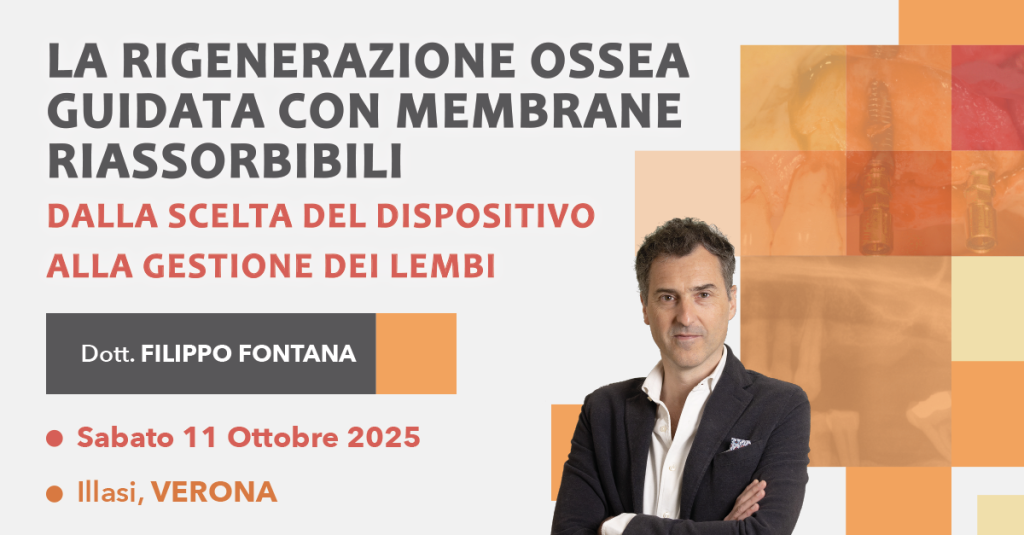 La rigenerazione ossea guidata con membrane riassorbibili