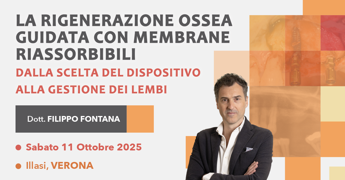 La rigenerazione ossea guidata con membrane riassorbibili