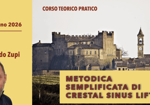 METODICA SEMPLIFICATA DI CRESTAL SINUS LIFT