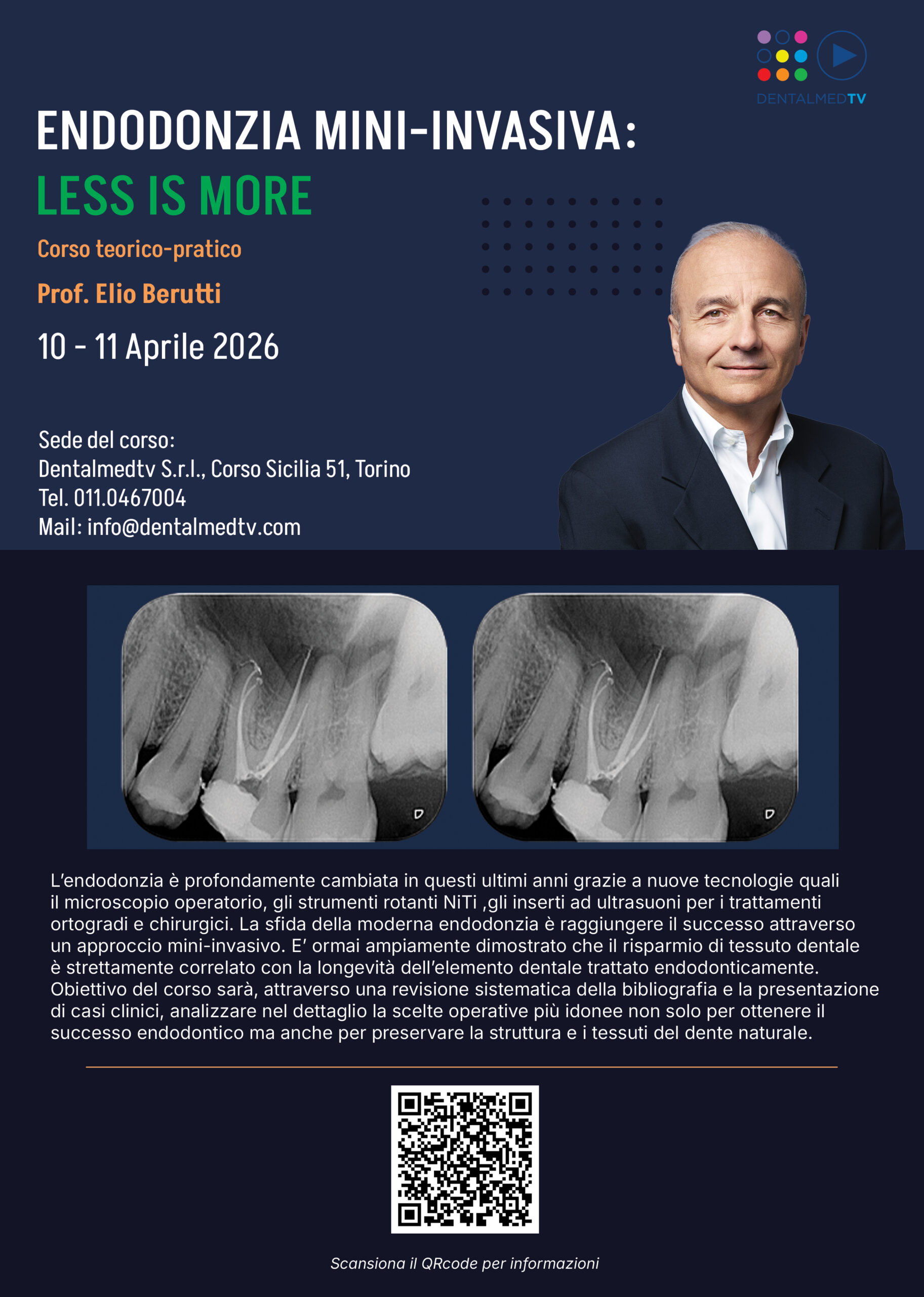 ENDODONZIA MINI-INVASIVA: LESS IS MORE