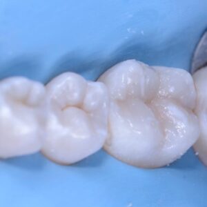 Aveta Benedettas Dr., Italy